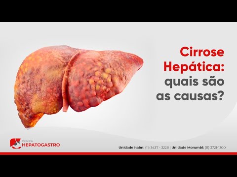 Cirrose Hepática: quais são as causas? | Dr. Paolo Salvalaggio CRM 143673