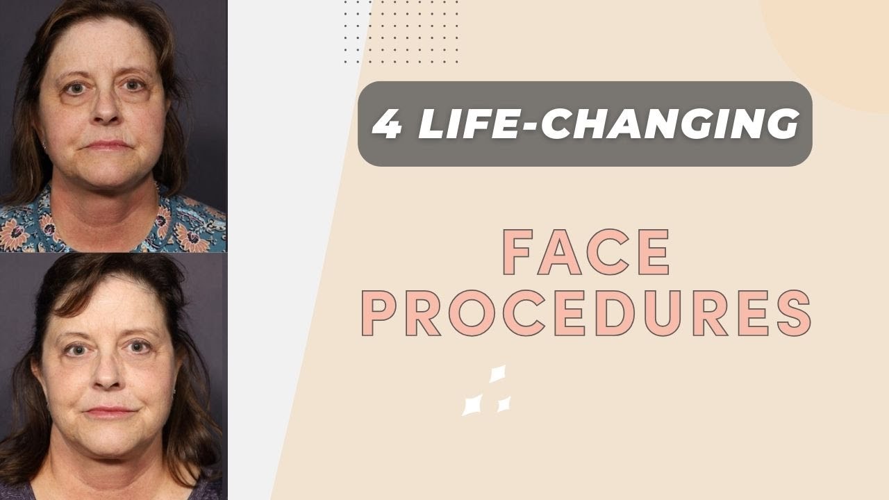 4 Procedures That Will Change the Way You Think About Face Lift Surgery
