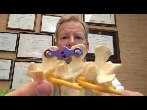 New Hope for Lumbar stenosis