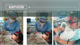 Dryshield aplicado en Odontopediatría. Caso 1