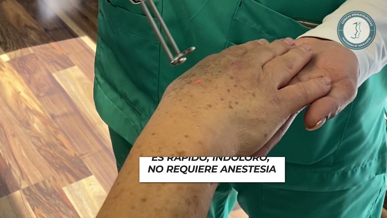 🤔😲¿Ya Conoces Todos Los Tratamientos Que el Láser Q-switched Puede Hacer ✅Ventajas y Beneficios😎