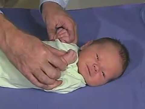 How dou you know your kids reflexes is normal