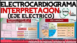 ELECTROCARDIOGRAMA INTERPRETACIÓN | GuiaMed