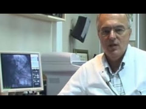 CUVENI KARDIOLOG OTKRIVA: Blizi se srcani udar ako visina donjeg pritiska prelazi ovu vrednost!