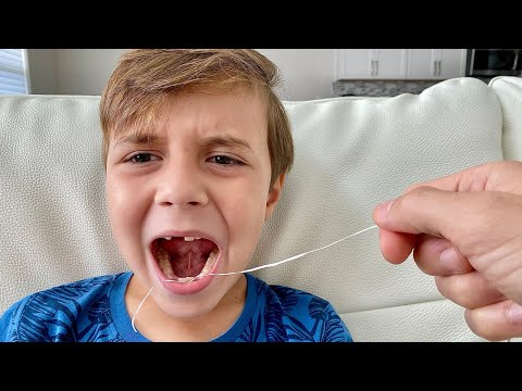 ARRANCAMOS O DENTE DO MARCOS COM FIO DENTAL - Família Brancoala