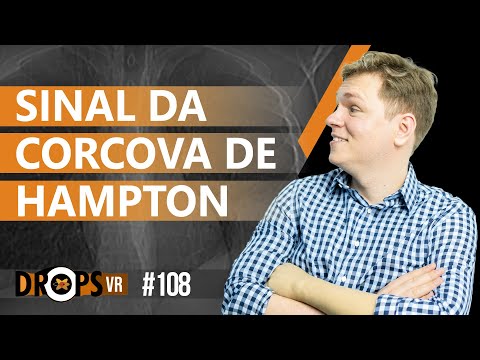 SINAL DA CORCOVA DE HAMPTON - VOCÊ SABE IDENTIFICAR?