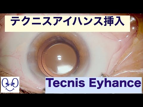 オロンセファインについて詳しく解説