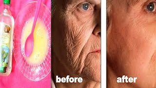 STRONG TREATMENT + MASSAGE FOR  FACE AND MOUTH WRINKLES  |CLEAR  WRINKLES IN 3 DAYS