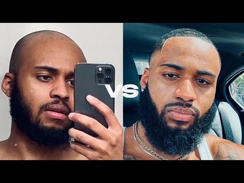 How To Comeback UNRECOGNIZABLE in 84 Days