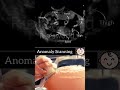 Anomaly Scanning