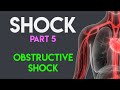 Obstructive Shock | Shock (Part 5)