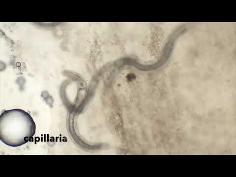 Watch Video on YouTube