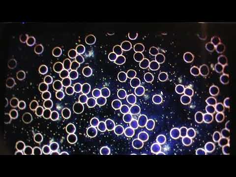 Campo escuro exame---após uso de água com carga de H2.