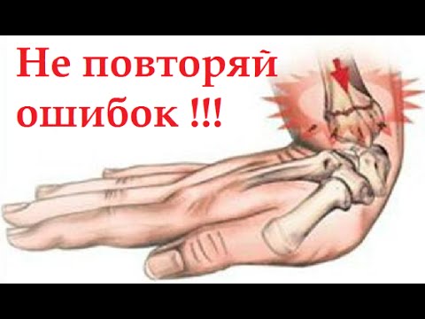 Пантогор гель для суставов купить в воронеже цена Артрит коленных суставов упражнениями