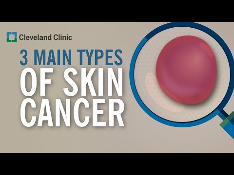3 Types of Skin Cancer