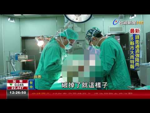 小腿長水泡 連抹5條藥膏退休師敗血症