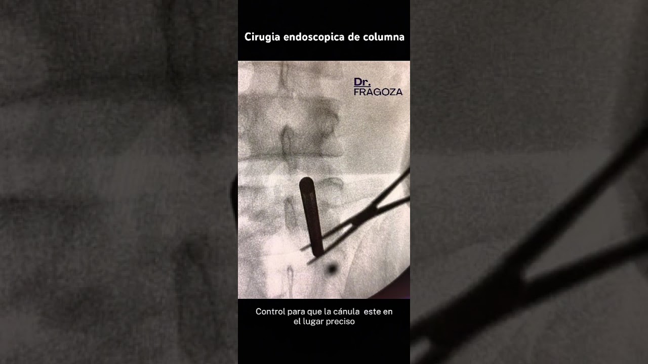 Valente Fragoza Padilla-24