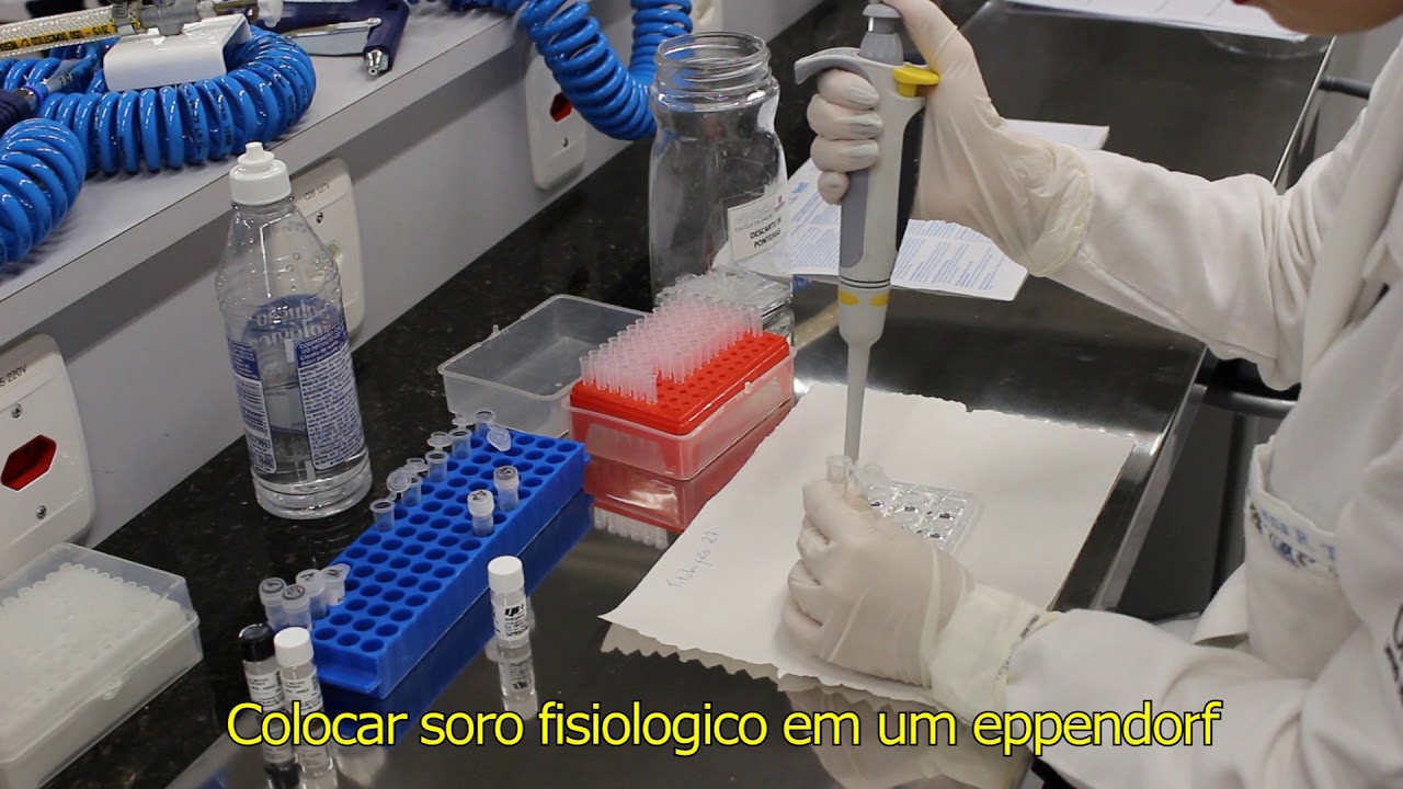 ACIII-Técnica de VDRL