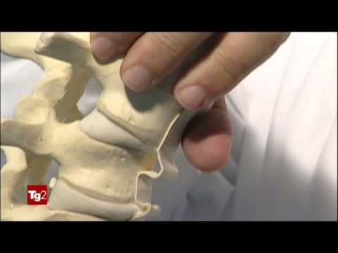 Vitamina B6 da osteocondrosi Radiografie della colonna cervicale a Yaroslavl