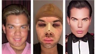 Rodrigo Alves Makeover ( plastic surgery )