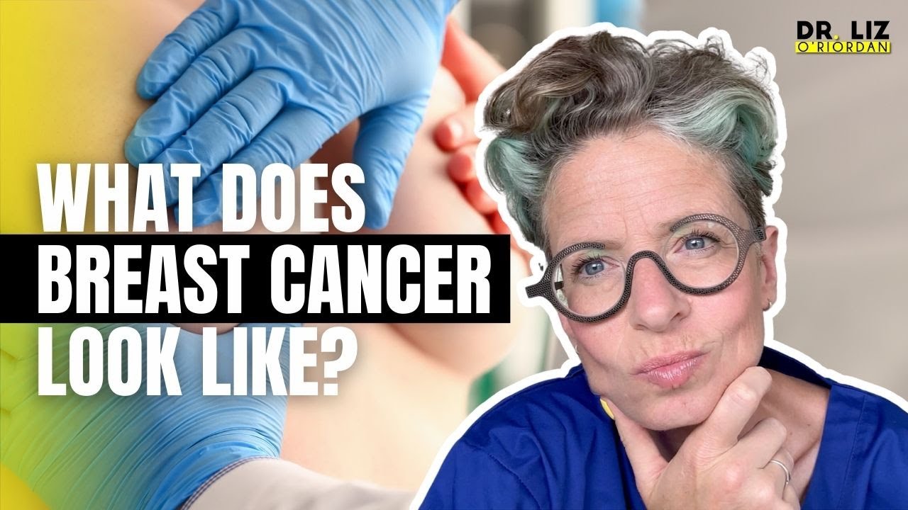 Do NOT Ignore These 11 Breast Changes | Not Just Lumps!