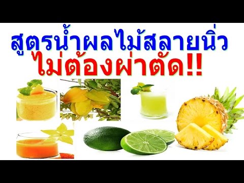 ทารกรูปภาพโรคสะเก็ดเงิน กลากและการรักษา ประเภท