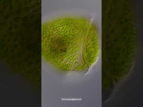 Stentor pyriformis en el agua de una arenera de Artilleros Colonia Uruguay