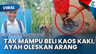 Viral Ayah Oleskan Arang di Kaki Anak demi Bisa Sekolah, Diduga Tak Mampu Beli Kaos Kaki
