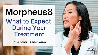 What to Expect During Your Morpheus8 Treatment