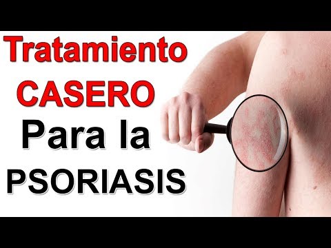 En que crece la eccema Galen sobre la psoriasis
