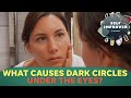 A Dermatologist Reveals Why You Get Dark Circles Under Your Eyes SELF IMPROVED