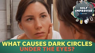 A Dermatologist reveals why you get dark circles under your eyes | SELF IMPROVED