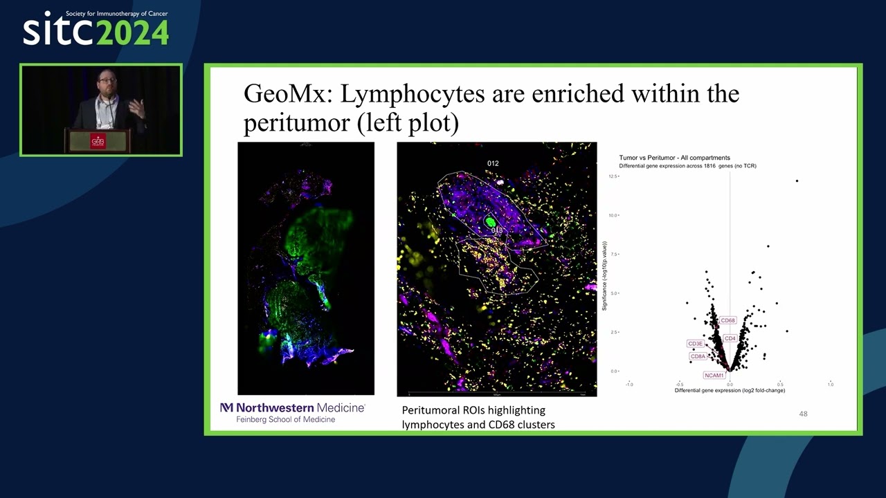 Using Adaptive Immune Receptor Repertoire Profiling to Characterize Rare Immune Excluded Tumors
