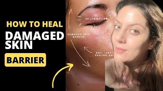How To Heal Damaged Skin Barrier | How to treat broken skin barrier | Nipun Kapur