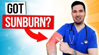 How to get rid of sunburn fast on face and itchy relief