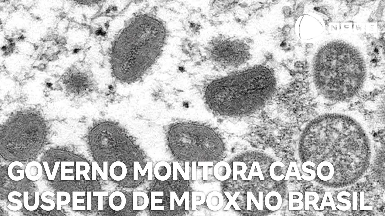 Governo monitora passageiro que chegou em Guarulhos com suspeita de mpox