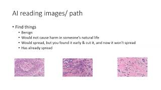 How To Talk Dirty To A Cancer Woman