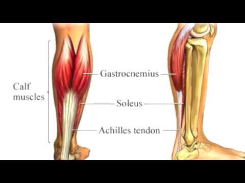 What Causes Achilles Tendonitis?