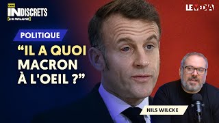 MACRON N'A QU'UN ŒIL : COMMENT LE PRÉSIDENT INSTRUMENTALISE SON PROBLÈME DE SANTÉ