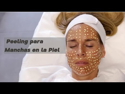 Peeling para Manchas en la Piel