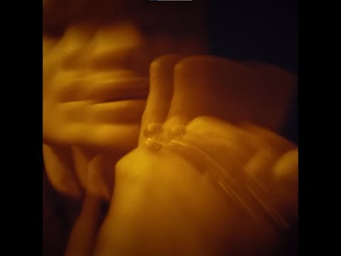 [FREE] LILDRUGHILL x FENDIGLOCK x MAYOT type beat - Koma (prod. skotty)