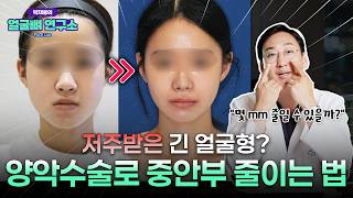 저주받은 얼굴형 1위? 중안부 긴 얼굴, 양악수술로 줄일 수 있을까?