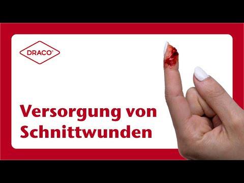 Versorgung von tiefen Schnittwunden – der DRACO® Videoblog