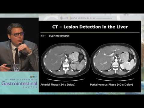 Tandem Talk 1: Imaging in NET - Contribution of CT and MRI