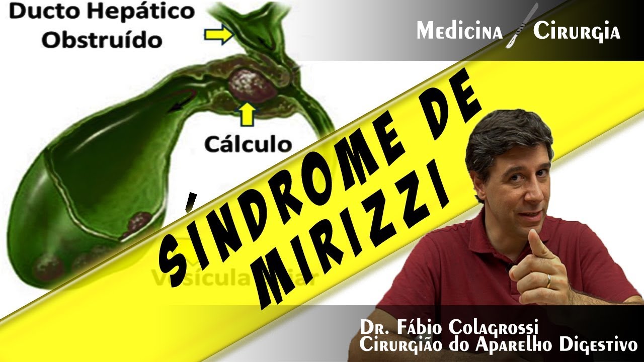 SÍNDROME DE MIRIZZI