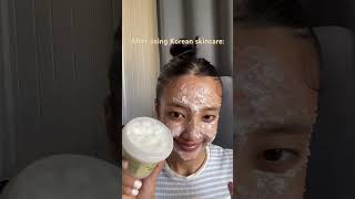 Download lagu Kulit muka sebelum dan sesudah menggunakan skincare Korea #skincare #beautyadvice #skinaesthetics mp3