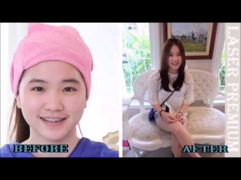 โบท็อก ที่ไหนดี