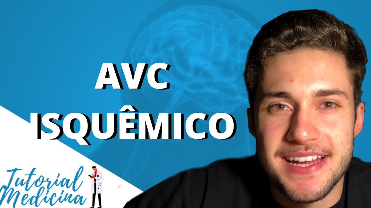 AVC Isquêmico - Acidente Vascular Cerebral Isquêmico