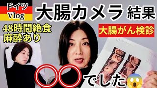 【初の大腸がん検診】大腸カメラで◯◯が見つかった!! 怖いので麻酔しました #大腸がん #大腸内視鏡検査 #50代 #ドイツ