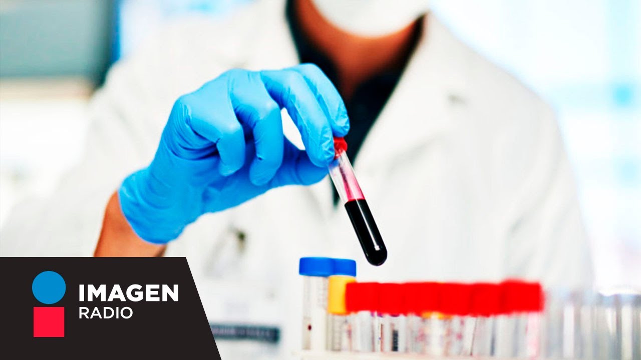 Aldo Scherling Ocampo-7